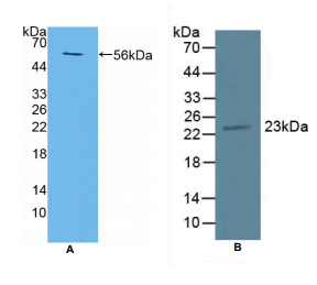 小鼠跨膜蛋白27(TMEM27)多克隆抗体