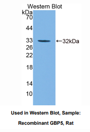 大鼠鸟苷酸结合蛋白5(GBP5)多克隆抗体