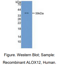 人花生四烯酸-12-脂加氧酶(ALOX12)多克隆抗体