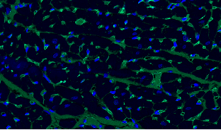 https://img.medsci.cn/09f7f9b396aaea8c5a2398de56f920980d508f8e7313325b130eae0a6c633bd4.png