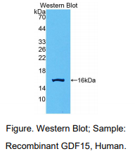 https://msimg.bioon.com/bionline/goods-no-pic.png