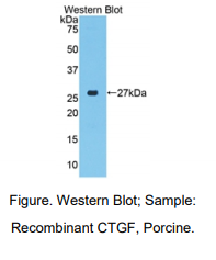 猪结缔组织生长因子(CTGF)多克隆抗体