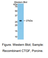 https://msimg.bioon.com/bionline/goods-no-pic.png