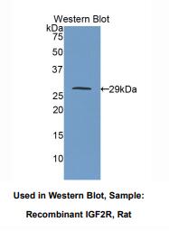 https://msimg.bioon.com/bionline/goods-no-pic.png