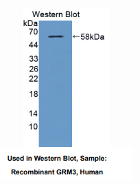 https://msimg.bioon.com/bionline/goods-no-pic.png