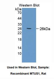 大鼠线粒体肿瘤抑制因子1(MTUS1)多克隆抗体