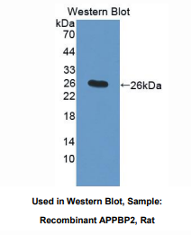 https://msimg.bioon.com/bionline/goods-no-pic.png