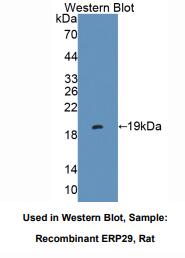 https://msimg.bioon.com/bionline/goods-no-pic.png