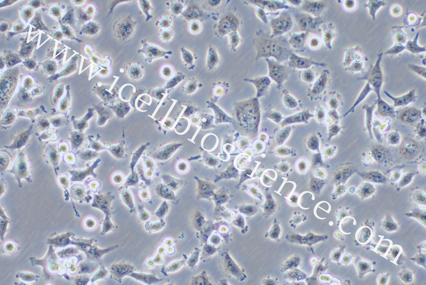 CAL-62细胞/CAL62细胞/CAL-62/CAL62/人甲状腺癌细胞（未分化）
