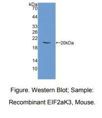 小鼠真核翻译起始因子2α激酶3(EIF2aK3)多克隆抗体