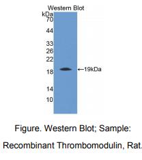 https://msimg.bioon.com/bionline/goods-no-pic.png