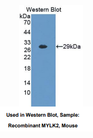 https://msimg.bioon.com/bionline/goods-no-pic.png