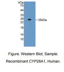 人细胞色素P450家族成员26A1(CYP26A1)多克隆抗体
