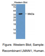 https://msimg.bioon.com/bionline/goods-no-pic.png