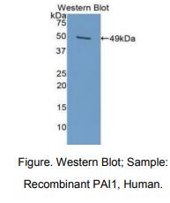 人纤溶酶原激活物抑制因子1(PAI1)多克隆抗体