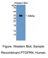 https://msimg.bioon.com/bionline/goods-no-pic.png