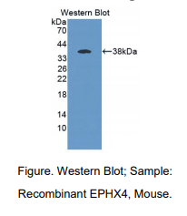 小鼠环氧化合物水解酶4(EPHX4)多克隆抗体