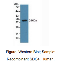 https://msimg.bioon.com/bionline/goods-no-pic.png