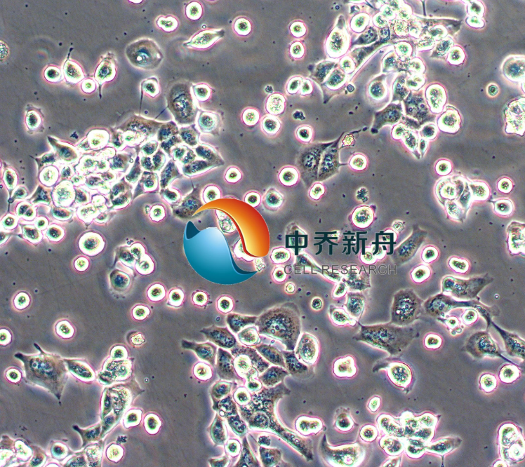 人非小细胞肺癌鳞癌细胞