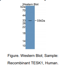 人睾丸特异性激酶1(TESK1)多克隆抗体
