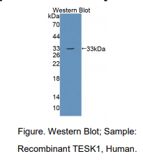 https://msimg.bioon.com/bionline/goods-no-pic.png