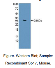 https://msimg.bioon.com/bionline/goods-no-pic.png