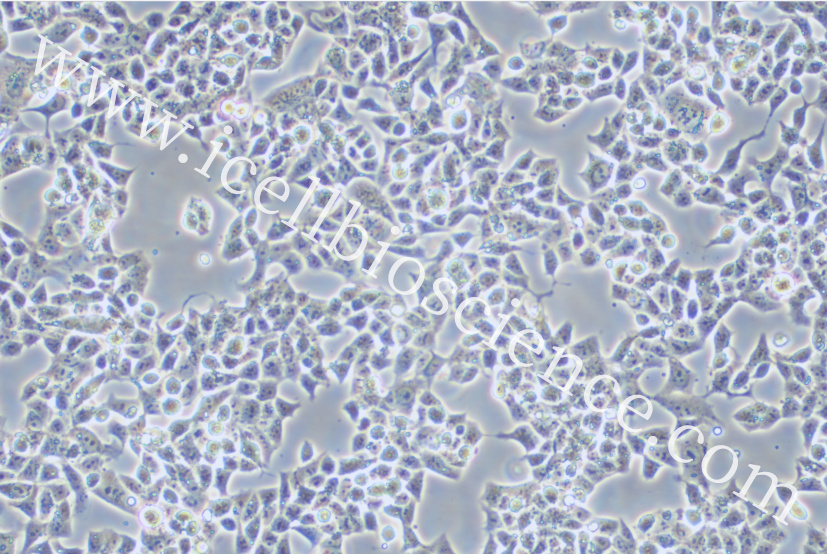 RPMI-2650细胞/RPMI2650细胞/RPMI-2650/RPMI2650/人鼻腔上皮细胞