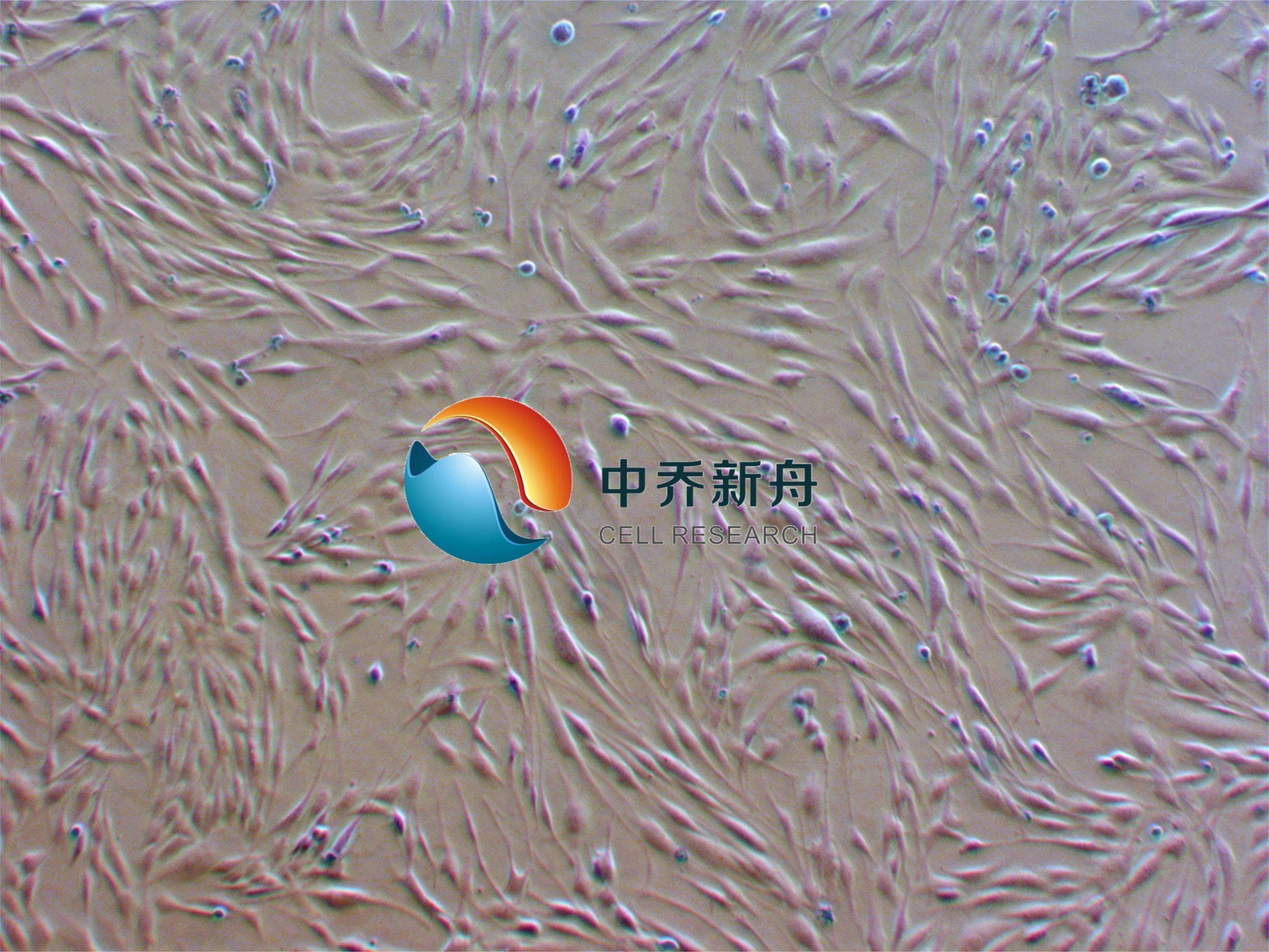 人肺成纤维细胞永生化
