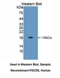 https://msimg.bioon.com/bionline/goods-no-pic.png