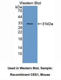 https://msimg.bioon.com/bionline/goods-no-pic.png