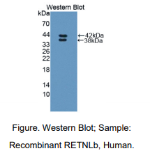 https://msimg.bioon.com/bionline/goods-no-pic.png