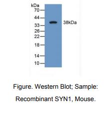 https://msimg.bioon.com/bionline/goods-no-pic.png