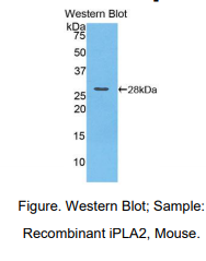 小鼠钙非依赖性磷脂酶A2(iPLA2)多克隆抗体
