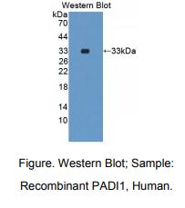 https://msimg.bioon.com/bionline/goods-no-pic.png