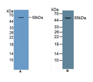 大鼠钙/钙调蛋白依赖性蛋白激酶Ⅱα(CAMK2a)多克隆抗体