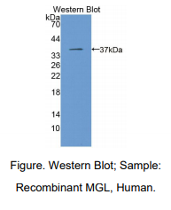 https://msimg.bioon.com/bionline/goods-no-pic.png