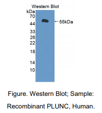 https://msimg.bioon.com/bionline/goods-no-pic.png