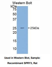 https://msimg.bioon.com/bionline/goods-no-pic.png