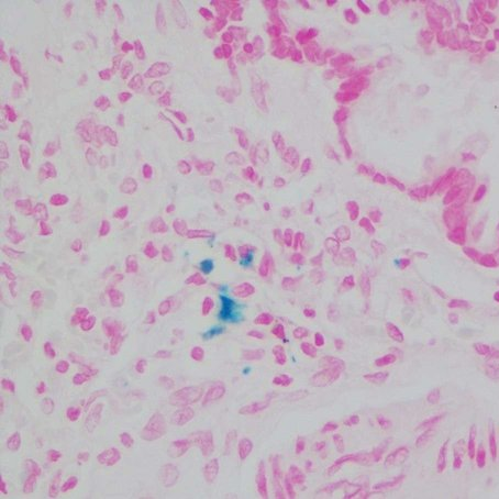 https://msimg.bioon.com/bionline/goods-no-pic.png