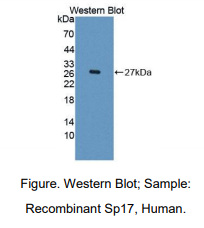 https://msimg.bioon.com/bionline/goods-no-pic.png