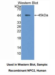 https://msimg.bioon.com/bionline/goods-no-pic.png