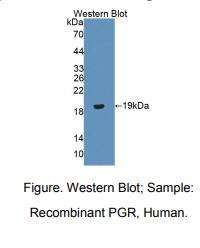 人孕酮受体(PGR)多克隆抗体