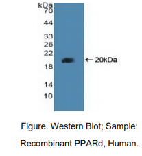 人过氧化物酶体增殖物激活受体δ(PPARd)多克隆抗体