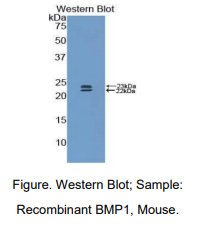 https://msimg.bioon.com/bionline/goods-no-pic.png