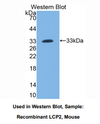 https://msimg.bioon.com/bionline/goods-no-pic.png