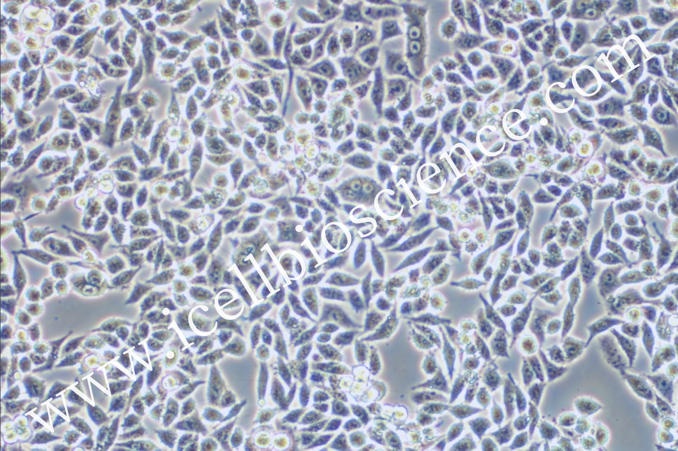 RKO细胞/RKO细胞/人结肠腺癌细胞