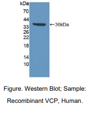 人含缬酪肽蛋白(VCP)多克隆抗体