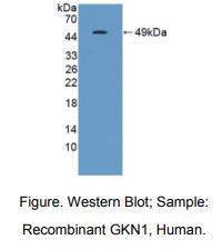 https://msimg.bioon.com/bionline/goods-no-pic.png