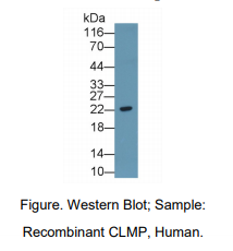 人柯萨奇病毒腺病毒受体样膜蛋白(CLMP)多克隆抗体