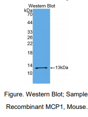 https://msimg.bioon.com/bionline/goods-no-pic.png